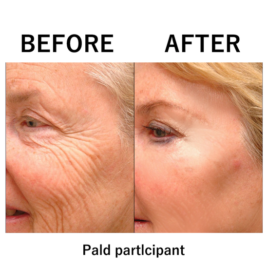 FirmxGlow™ - Lift & Firm Instant Face Tightener