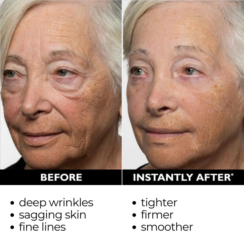 FirmxGlow™ - Lift & Firm Instant Face Tightener