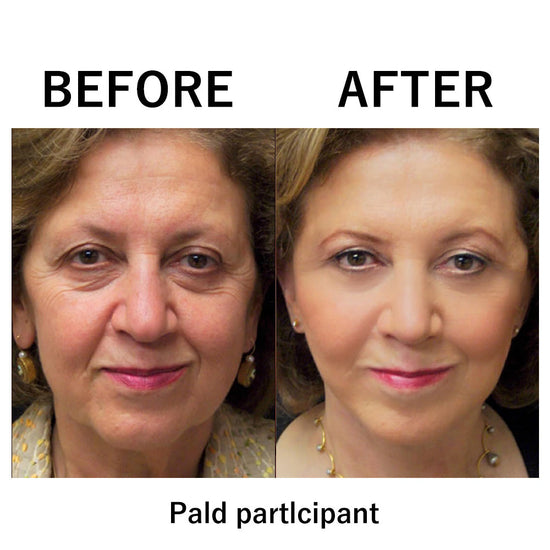 FirmxGlow™ - Lift & Firm Instant Face Tightener