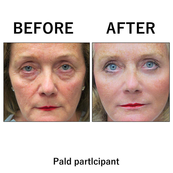 FirmxGlow™ - Lift & Firm Instant Face Tightener