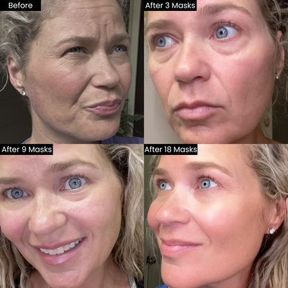 HydraGlow™ - Deep Face Mask