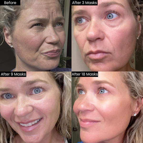 HydraGlow™ - Deep Face Mask