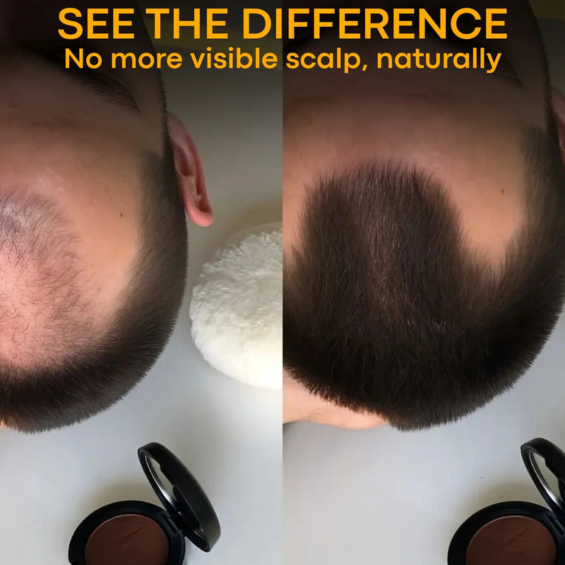 CrownFix™ - Your Hair’s Best Kept Secret